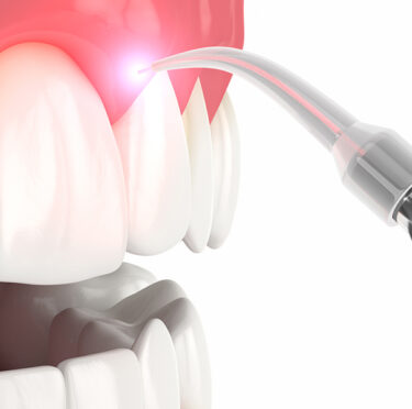 Concord Periodontics treatment model