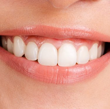Girl with healthy teeth